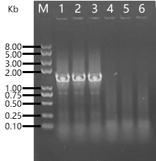 PCR agarose gel electrophoresis: 1, 2, 3 were white colonies, 4, 5 and 6 were blue colonies.