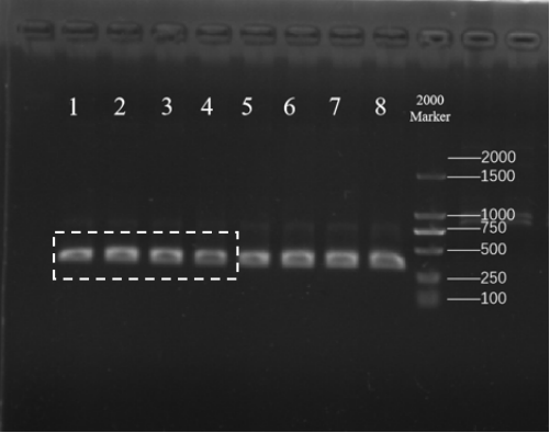 Eletrophoretic profile of the PCR result.png
